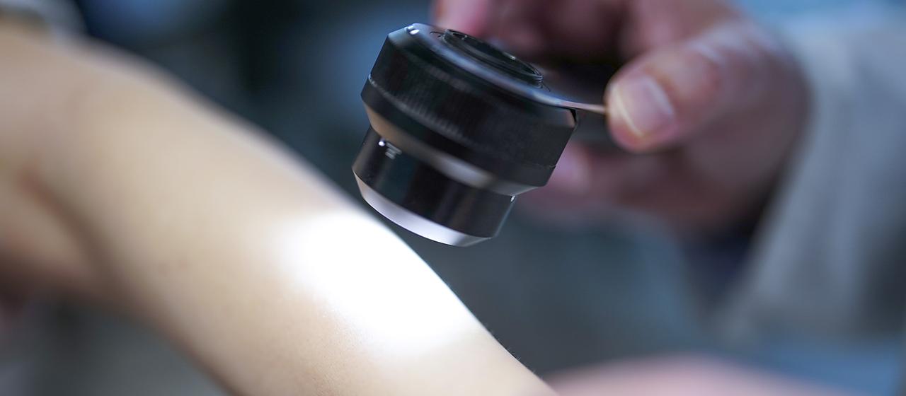 Hoffnung durch mRNA-Impfung gegen Hautkrebs